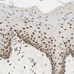 hnRNP K Antibody, Novus Biologicals 0.1mL; Unlabeled:Antibodies, Polyclonal